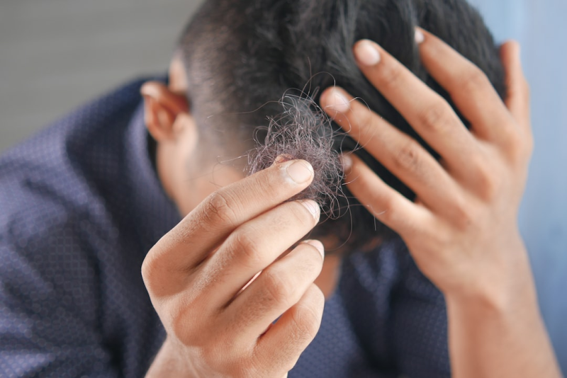 Passport Photo Hairline Display: Guidelines and Requirements